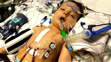 The Miraculous Power of Hope: A Story of Triumph Through Pediatric Heart Surgery Recovery